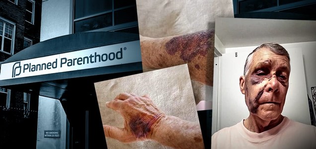 ACLJ Represents Two Elderly Pro-Lifers Who Were Brutally Beaten Unconscious by Pro-Abortion Radical While Peacefully Standing in Front of Planned Parenthood in Baltimore