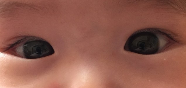 実際に二重になった 赤ちゃんの目を二重にする方法 ミイの日々 実際に二重になった 赤ちゃんの目を二重にする方法 ミイの日々