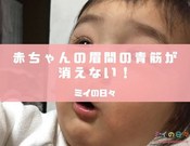 赤ちゃんの眉間の青筋はいつ消える 癇癪持ちって本当 ミイの日々