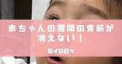 赤ちゃんの眉間の青筋はいつ消える 癇癪持ちって本当 ミイの日々 赤ちゃんの眉間の青筋はいつ消える 癇癪持ちって本当 ミイの日々