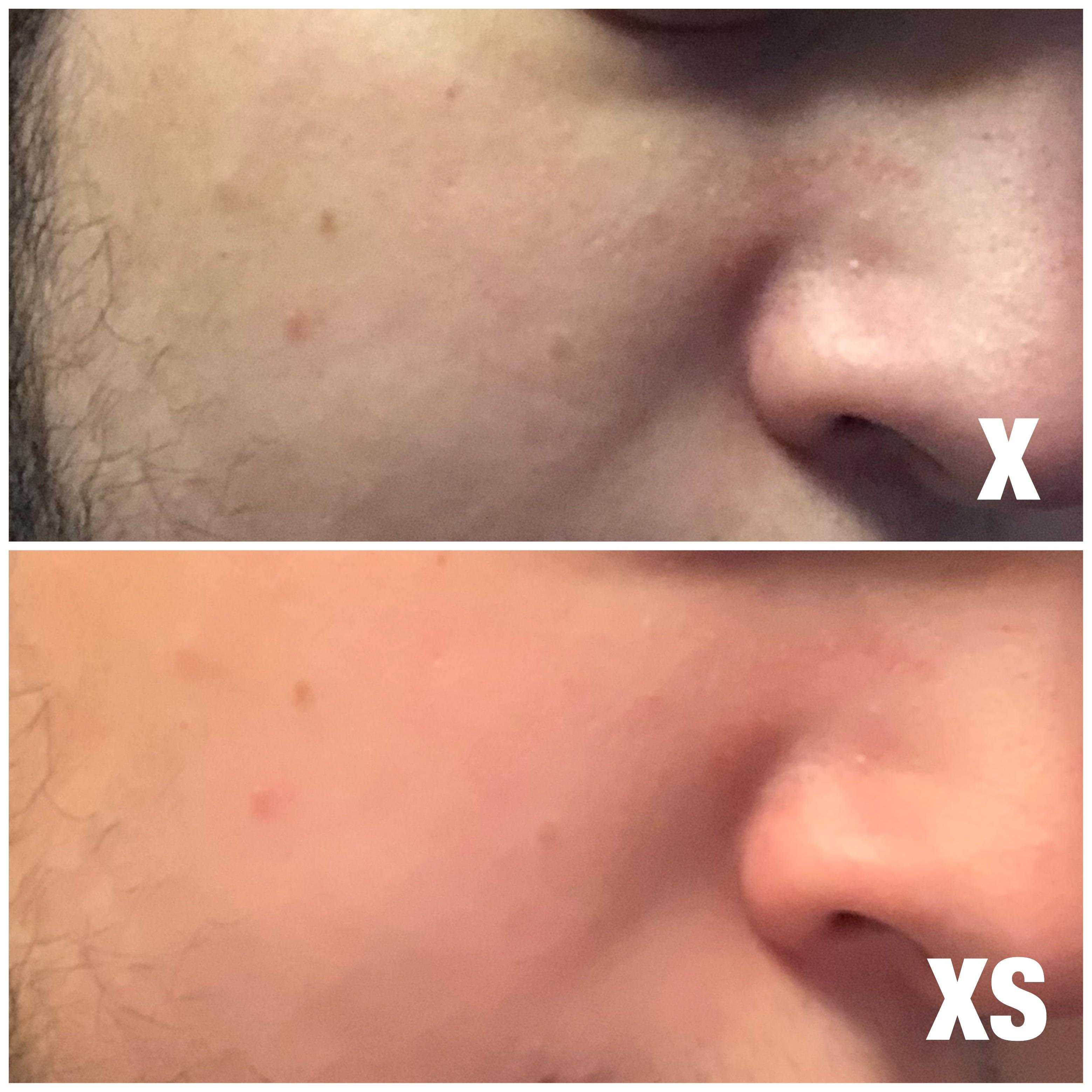 XS